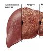 Je li moguće izliječiti difuzne promjene u jetri Difuzne promjene u ehostrukturi jetre